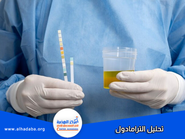 تحليل الترامادول